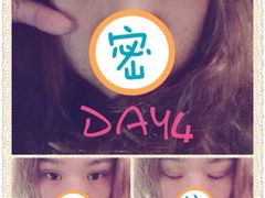 第四天-上海华安整形外科门诊部