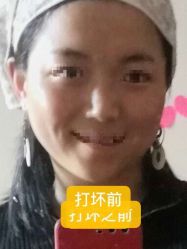 -上海玫瑰医疗美容医院