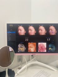 -亿美医疗美容·半岛大超炮官方授权店