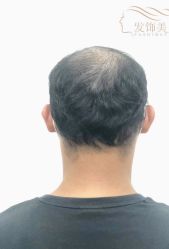 -发饰美男士增发补发假发定制店