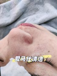 -SKIN79皮肤管理中心