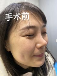 体验前-北京炫美医疗美容