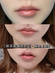 -上海漾颜医疗美容