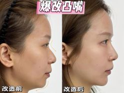 -Yestar重庆艺星医疗美容医院