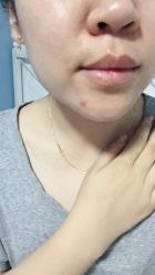 -觅屿日式脱毛美肤