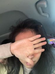 -章光101防脱养发荟