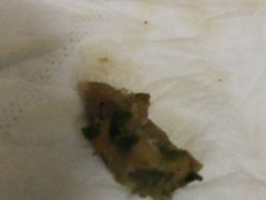 -草包包子铺(宽厚里店)