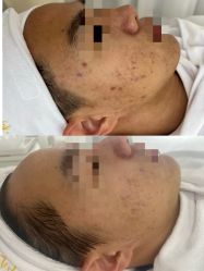 -康美贞·痘肌养护管理中心