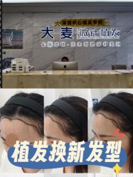 -大麦微针植发丨全国连锁