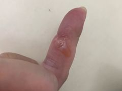 -无锡市第二人民医院(南院)