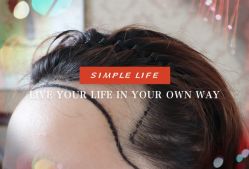 -大麦微针植发全国连锁