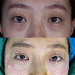 体验后-联合丽格·张菡丽格医疗美容