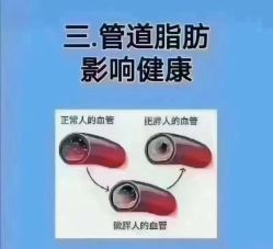 -香薇妮丝·定制减肥·身材管理