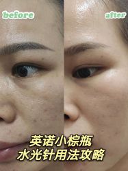 -天津健丽·去眼袋医疗美容机构