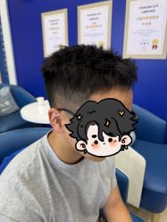 -大麦微针植发全国连锁