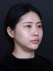 体验前-南宁华美医疗美容医院