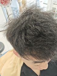 -大麦微针植发丨全国连锁