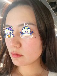 点击看大图 体验前-北京英煌医疗美容