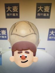 -大麦微针植发丨全国连锁