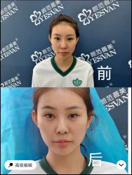 -武汉颜范薇美医疗美容门诊部