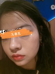 体验后-杭州医巢医疗美容