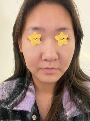 -海涛医疗美容·面部抗衰·注射美鼻