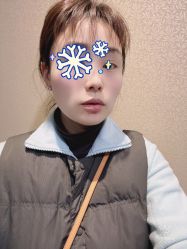 体验后-上海首尔丽格医疗美容医院