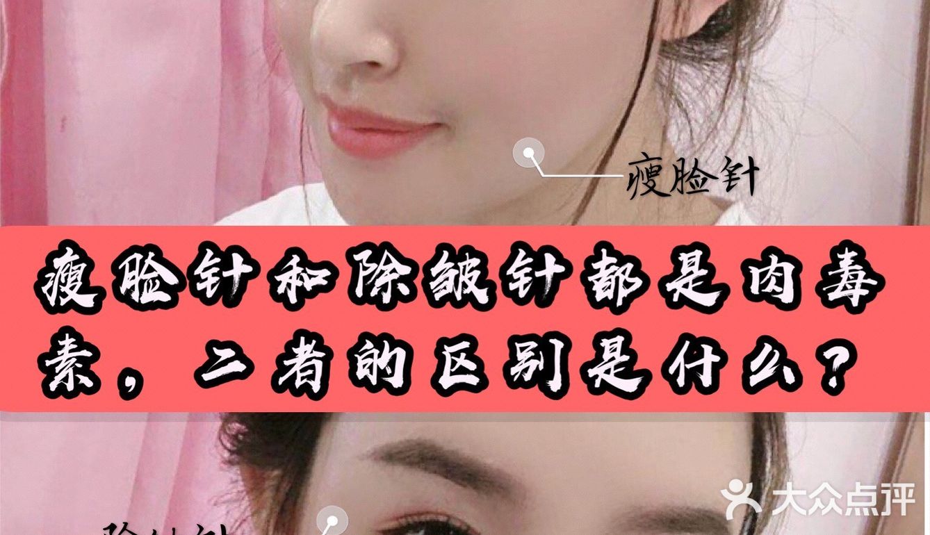 瘦脸针和除皱针都是肉毒素，二者的区别是什么？