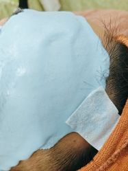 -苗医生专业祛痘