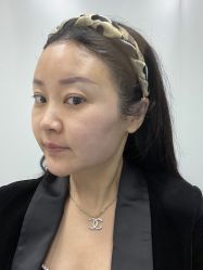 -海涛医疗美容·面部抗衰·注射美鼻