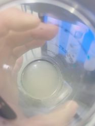 体验后-杭州奥拉克医疗美容门诊部