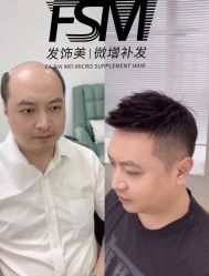 -发饰美男士增发补发假发定制店