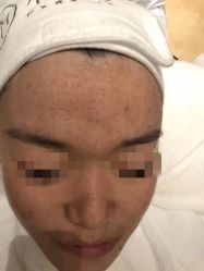 -友仟痘医生科学祛痘连锁