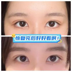 -素美医疗美容·西南眼鼻整形·修复基地