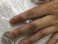 -世龙世家灰指甲·甲沟炎·跖疣护理·修脚(东江湾路店)