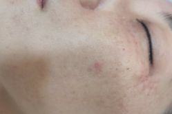 体验后-德媛医疗美容