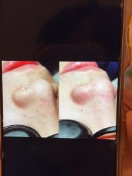 -苑苑vbeauty科技美容SPA