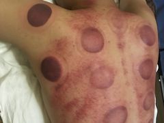 -御筋堂正骨推拿(星源国际店)