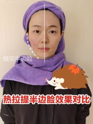 -深圳美莱医疗美容医院