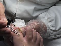 -新甲连锁灰指甲·甲沟炎·鸡眼(黑龙江路店)