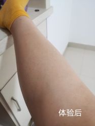 -嘉和医学脱毛中心