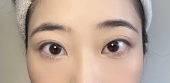 -广州健丽·去眼袋医疗美容机构