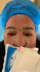 体验后-圣嘉新医疗美容医院