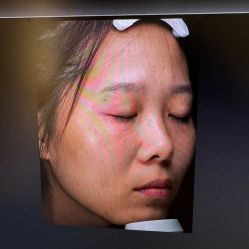 点击看大图 -铂特丽医美·眼鼻整形·光电美肤·注射抗衰