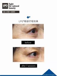 -克丽缇娜