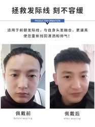 -发饰美男士增发补发假发定制店