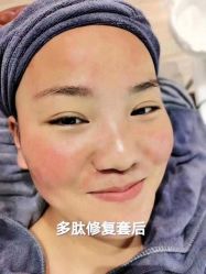 -理肤印象