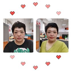 点击看大图 体验前-天津健丽·去眼袋医疗美容机构