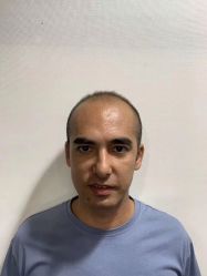 -发饰美男士增发补发假发定制店