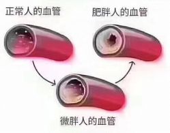 -香薇妮丝女子减肥院